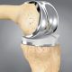 protesis-rodilla