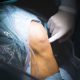 artroscopia de rodilla en IMTRA