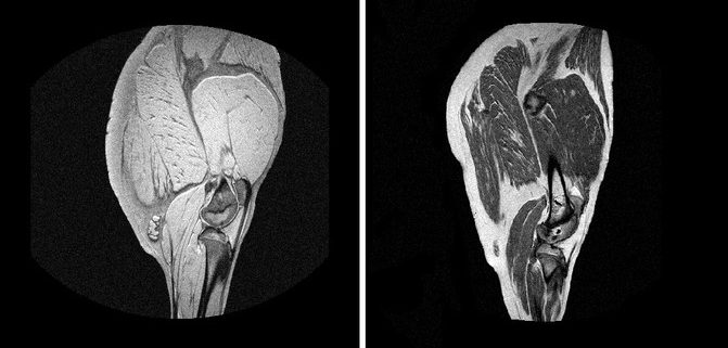 Imágenes de un jamón fresco y curado obtenidas con tecnología MRI. / TECAL-GIM (UEx)