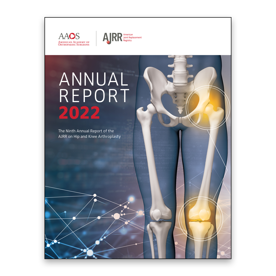 Disponible el informe anual del registro estadounidense de prótesis de rodilla y cadera