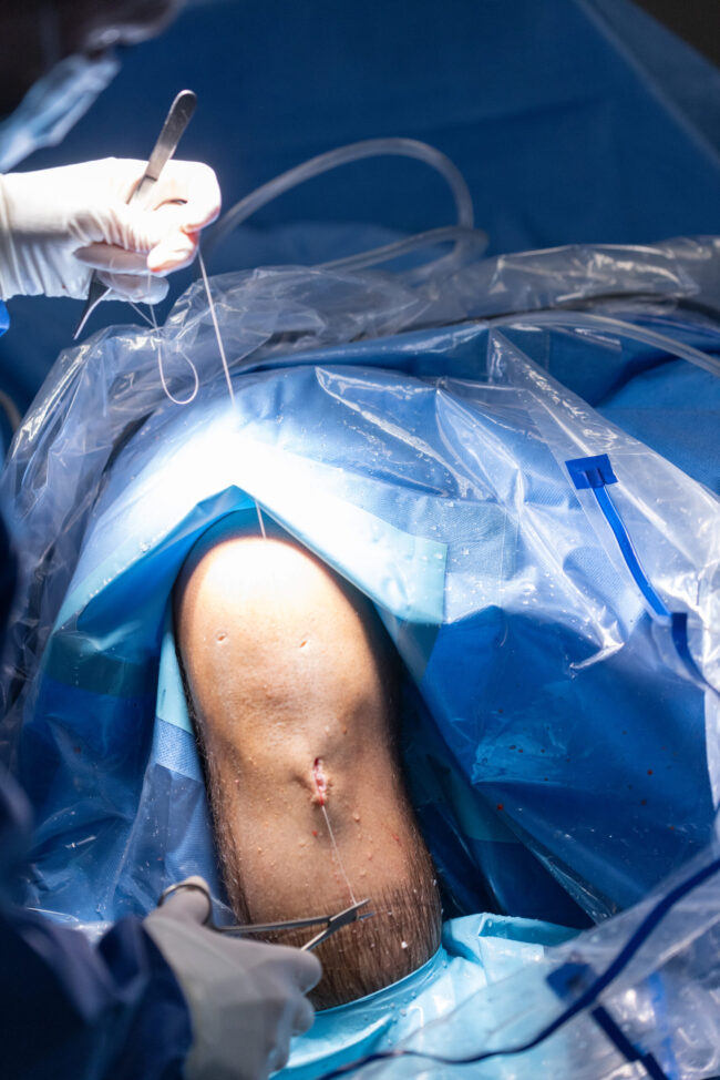 operación ligamento cruzado anterior rodilla